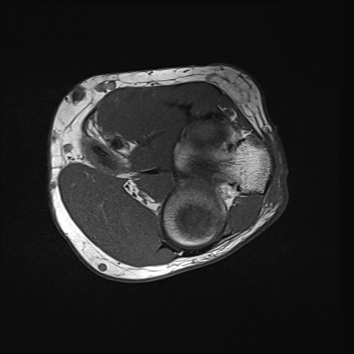 Click on the Serie image to view the images of Wieszt, Gnter